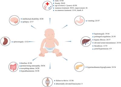 Mannose phosphate isomerase gene mutation leads to a congenital disorder of glycosylation: A rare case report and literature review